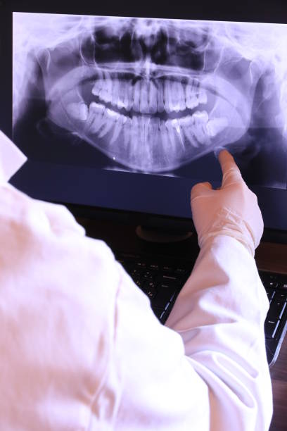 Best After-Hours Dental Trauma Care in Forest Meadows, CA